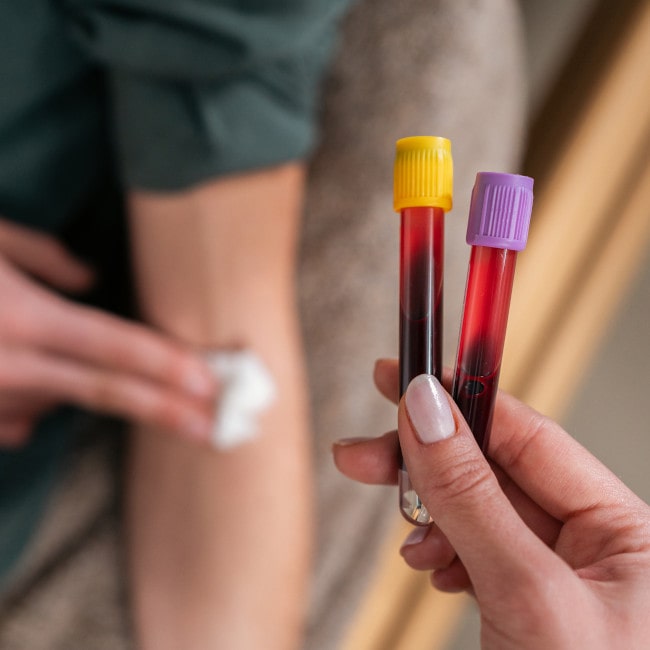 Podstawowe badania krwi – przygotowanie, przebieg, rodzaje