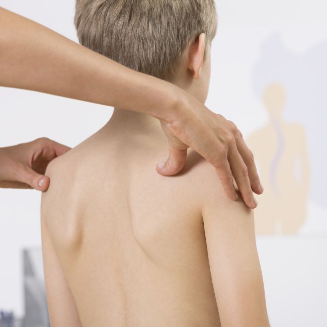 Fizjoterapeuta badający kręgosłup dziecka w celu wykrycia wad postawy